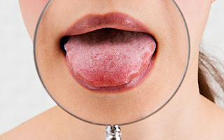 舌の痛みや痺れ